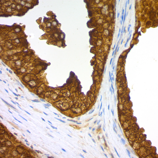 PSAP (Prostate Specific Acid Phosphatase); Clone PASE/4LJ (Ready-To-Use)